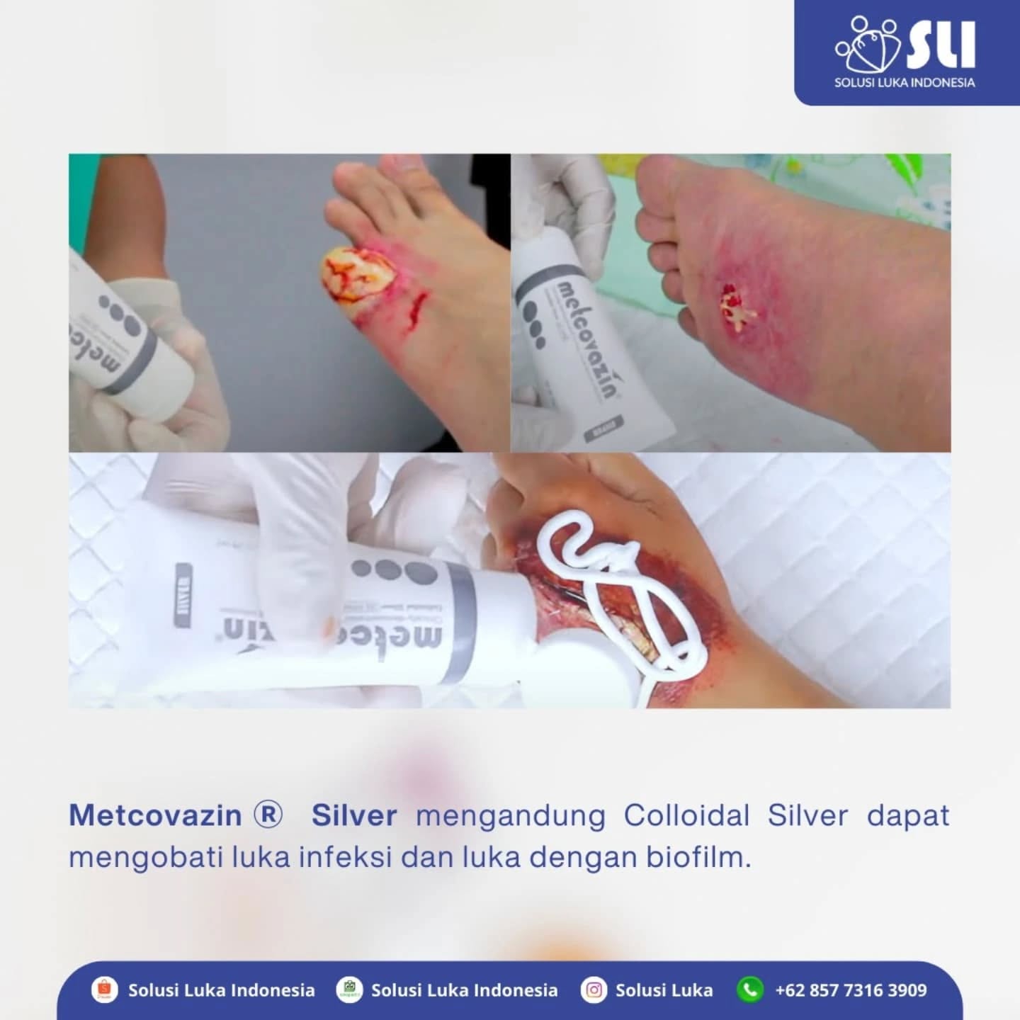 METCOVAZIN SILVER