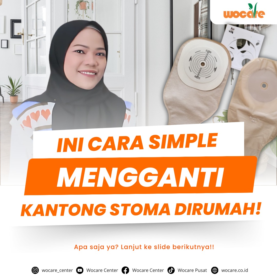 LAYANAN PERAWATAN STOMA GRATIS